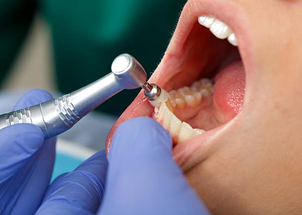 Best Tooth Extraction  in Riverside, PA